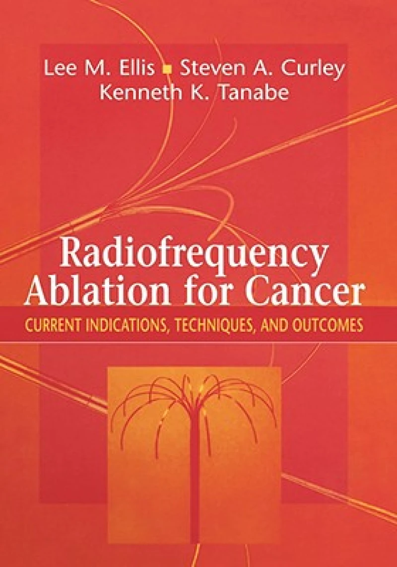 Radiofrequency Ablation for Cancer
