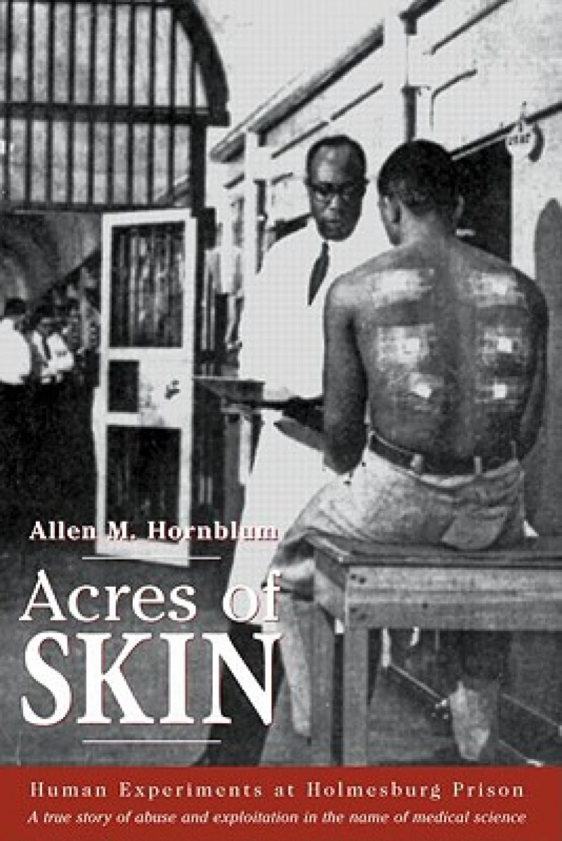 Acres of Skin