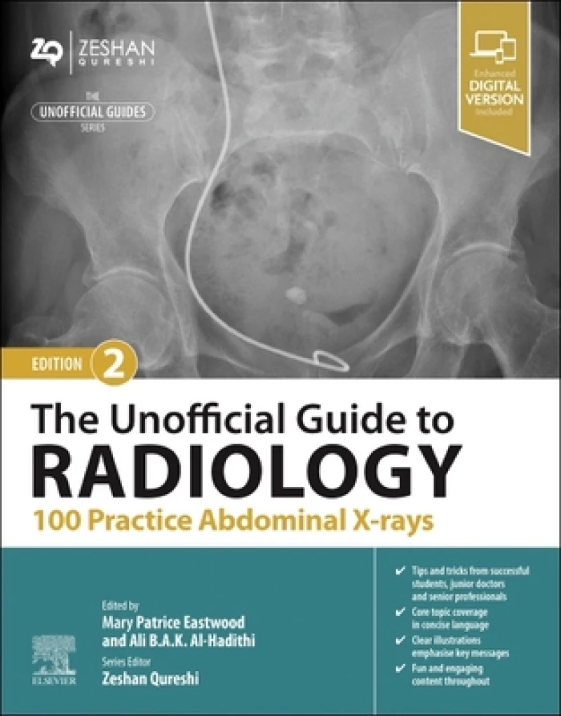 The Unofficial Guide to Radiology: 100 Practice Abdominal X-rays