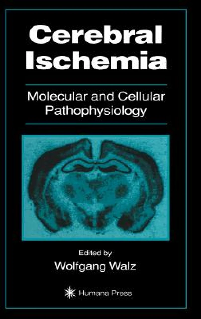 Cerebral Ischemia