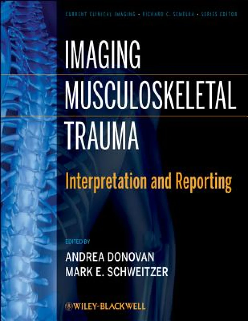 Imaging Musculoskeletal Trauma