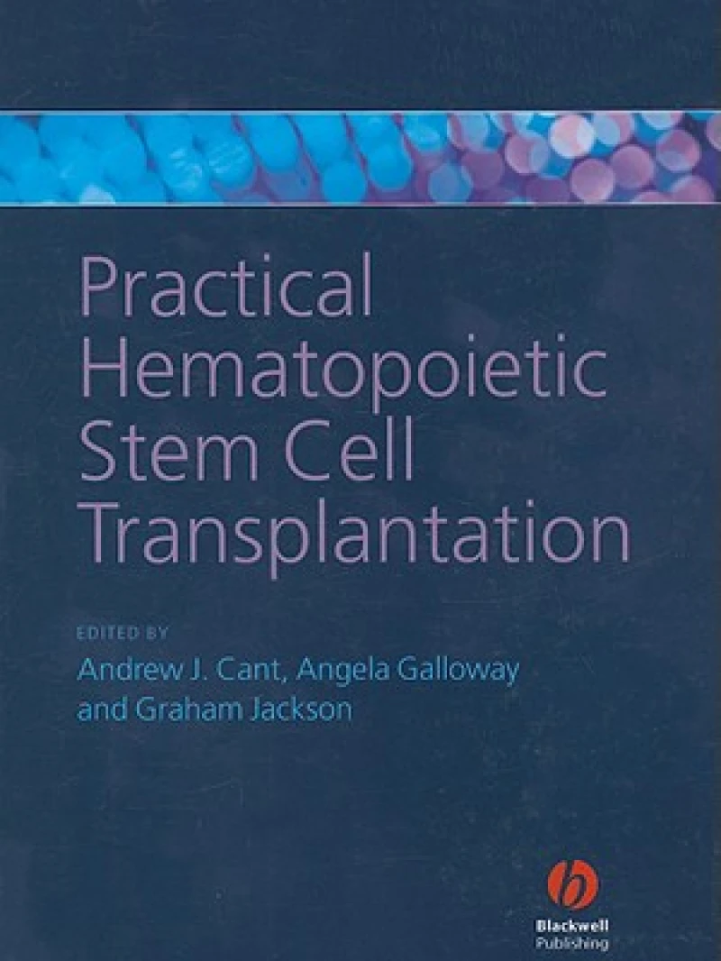 Practical Hematopoietic Stem Cell Transplantation