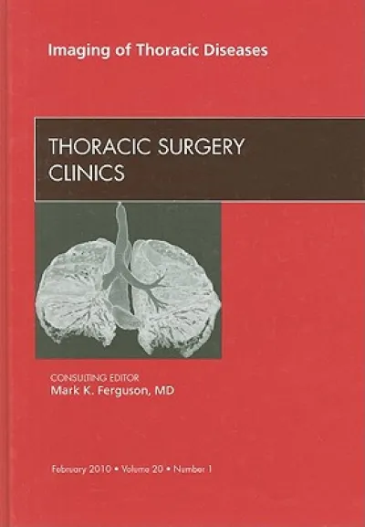 Imaging of Thoracic Diseases, An Issue of Thoracic Surgery Clinics