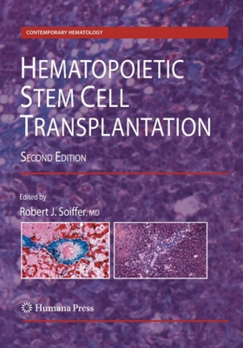 Hematopoietic Stem Cell Transplantation