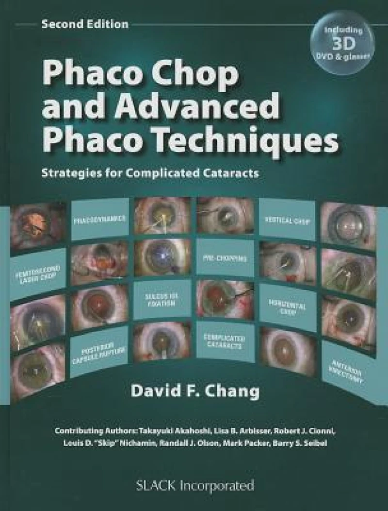 Phaco Chop and Advanced Phaco Techniques