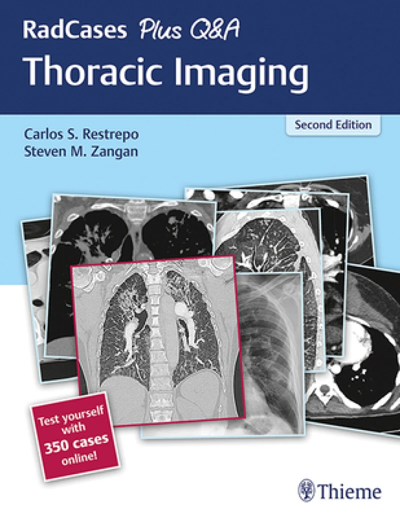 RadCases Plus Q&a Thoracic Imaging