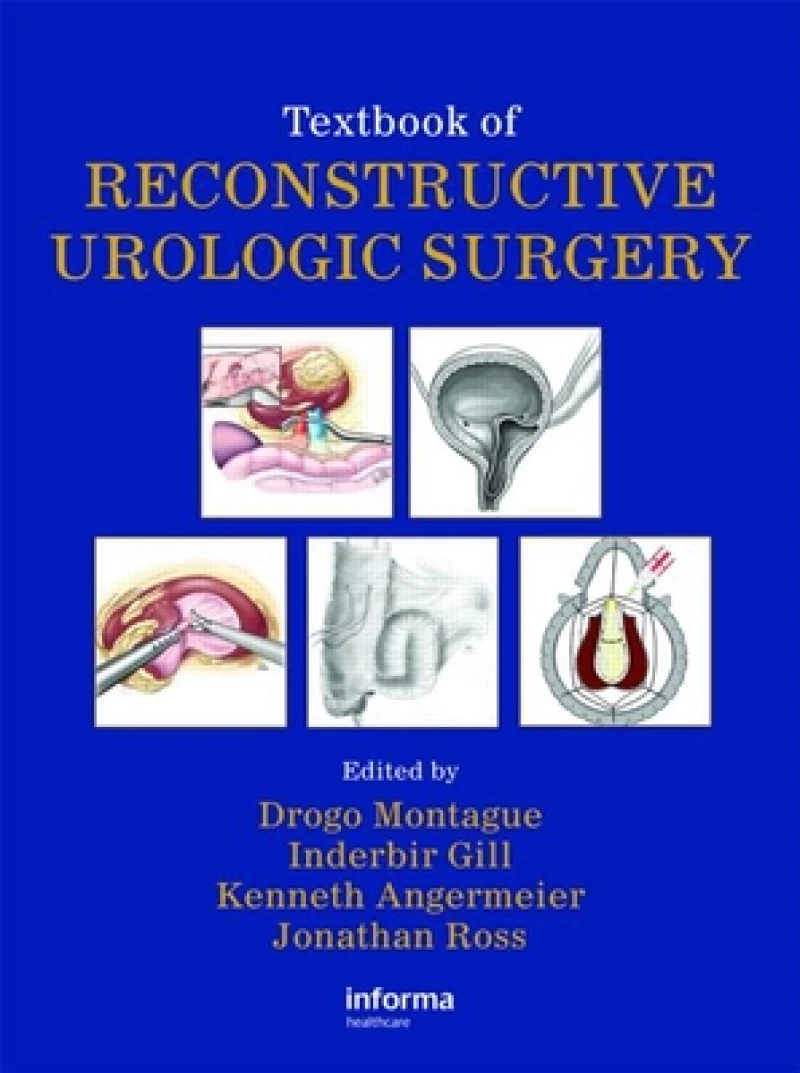 Textbook of Reconstructive Urologic Surgery