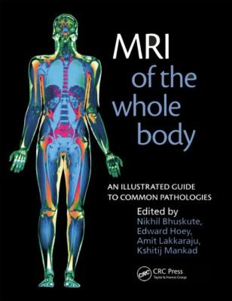MRI of the Whole Body