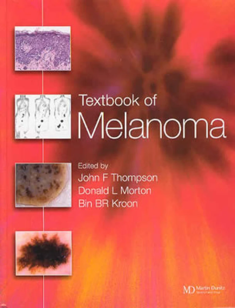 Textbook of Melanoma