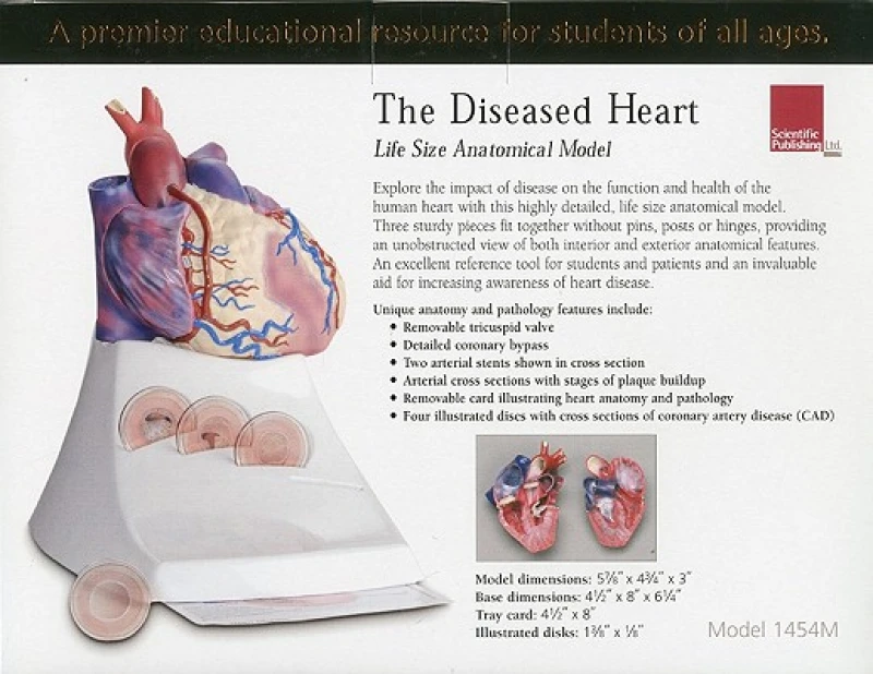 Life Size Diseased Heart Model