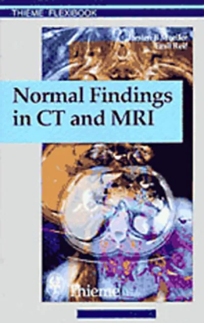 Normal Findings in CT and MRI, A1, Print