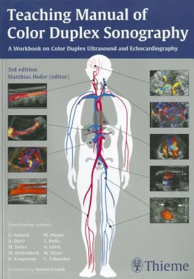 Teaching Manual of Color Duplex Sonography