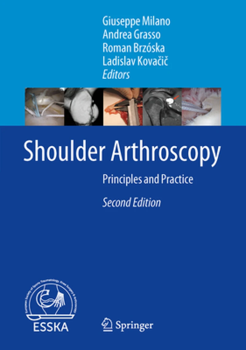 Shoulder Arthroscopy