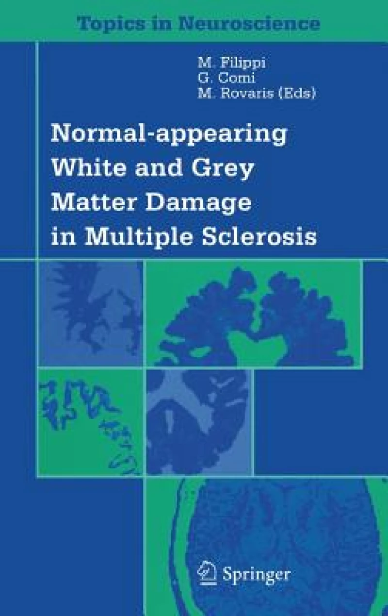 Normal-appearing White and Grey Matter Damage in Multiple Sclerosis