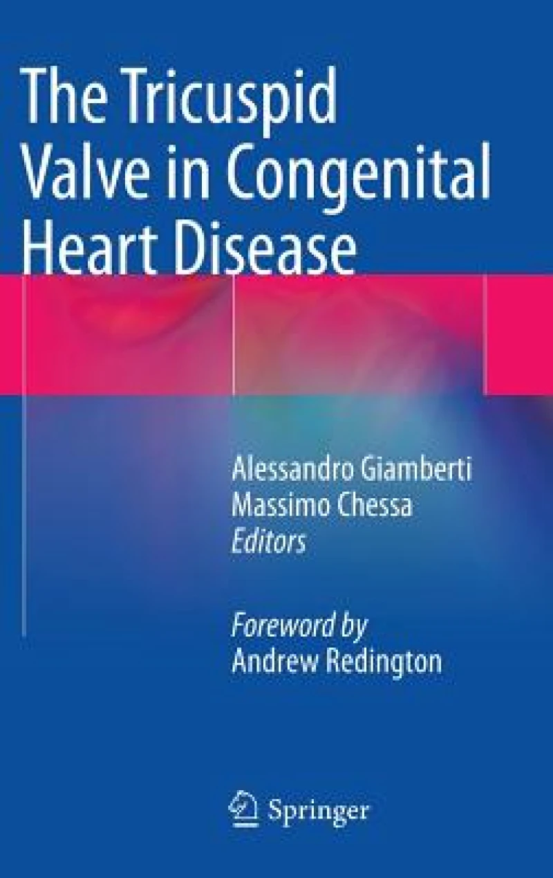 The Tricuspid Valve in Congenital Heart Disease