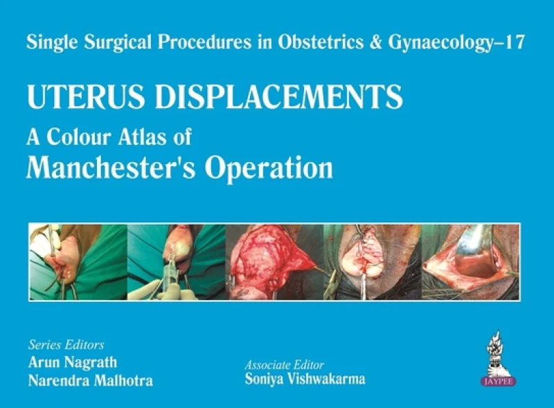 Single Surgical Procedures in Obstetrics and Gynaecology – 17 - UTERUS DISPLACEMENTS