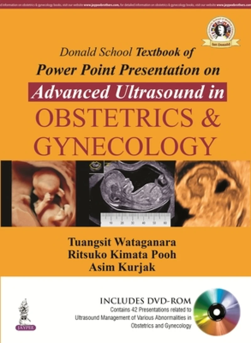 Donald School Textbook of Powerpoint Presentation on Advanced Ultrasound in Obstetrics & Gynecology