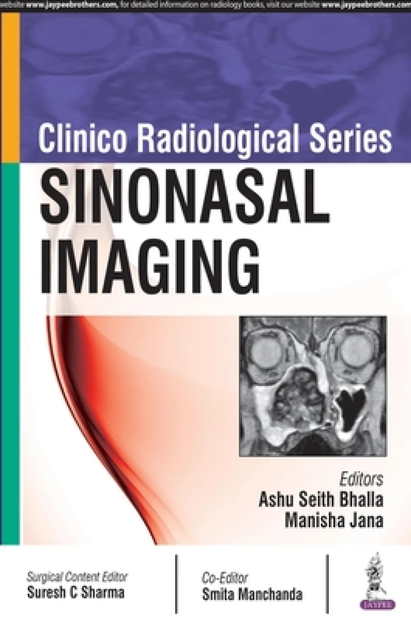 Clinico Radiological Series: Sinonasal Imaging