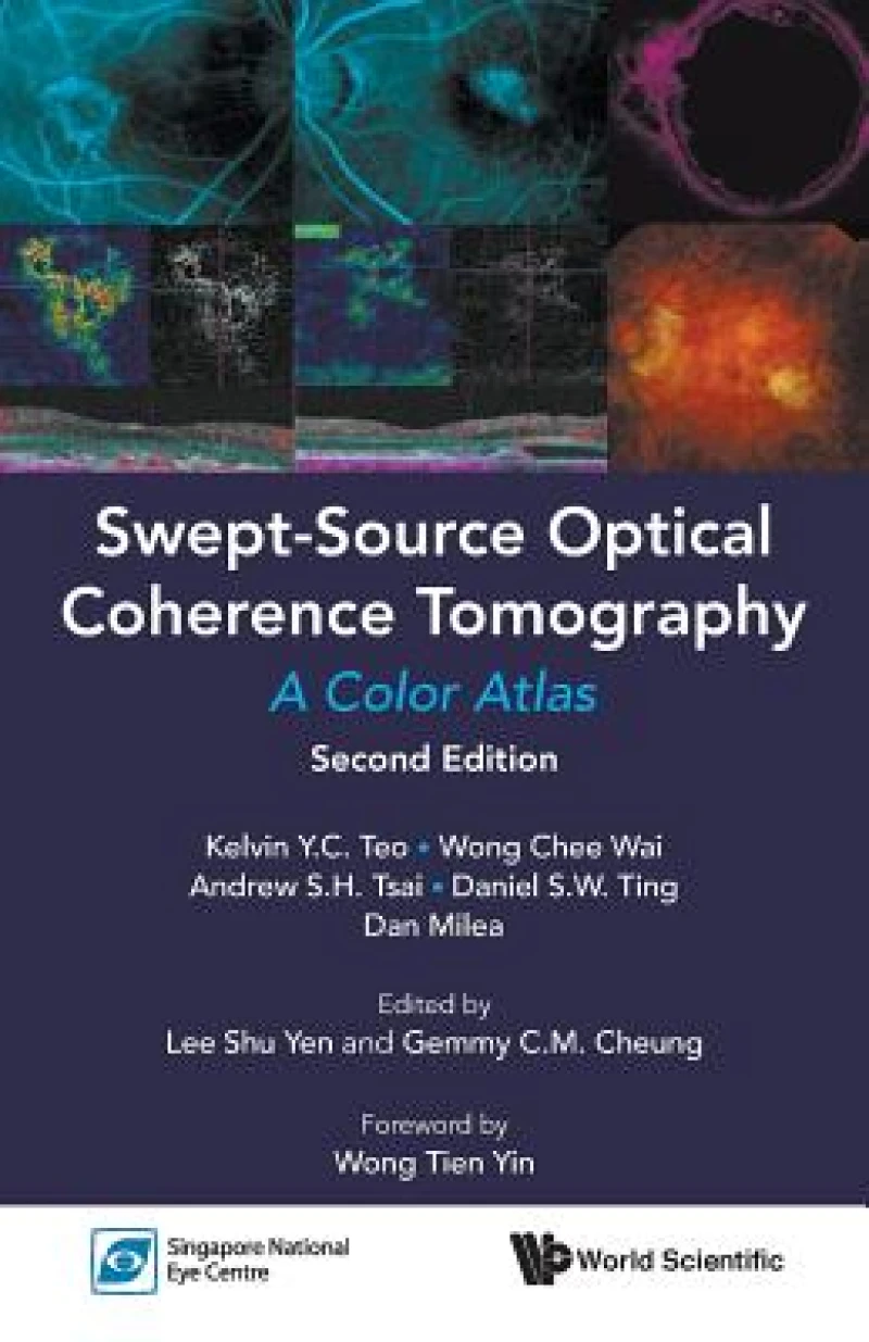 Swept-source Optical Coherence Tomography: A Color Atlas